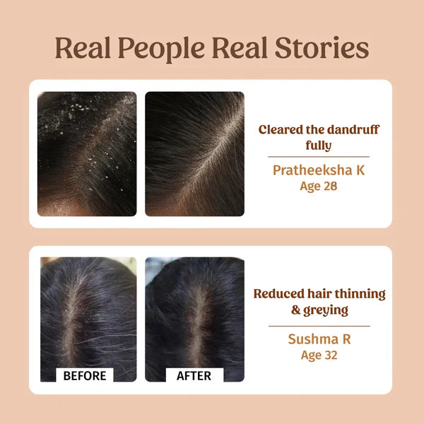 Herbal Shampoo (Dandruff Control) - Vilvah