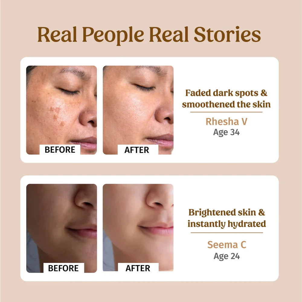 Ultra Moisturising Cream (Fine lines & Wrinkles) - Vilvah