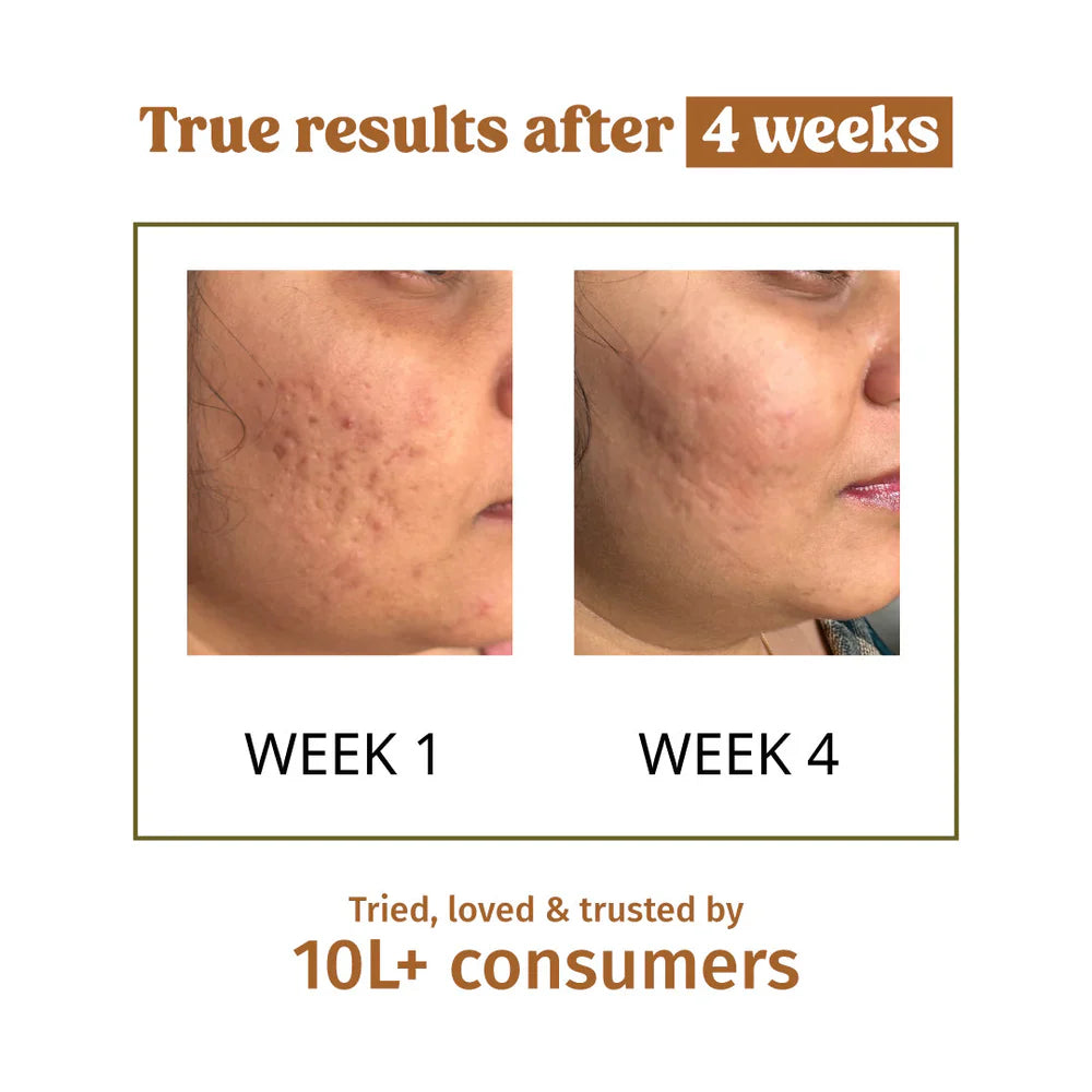 Milk Face Kit - Vilvah