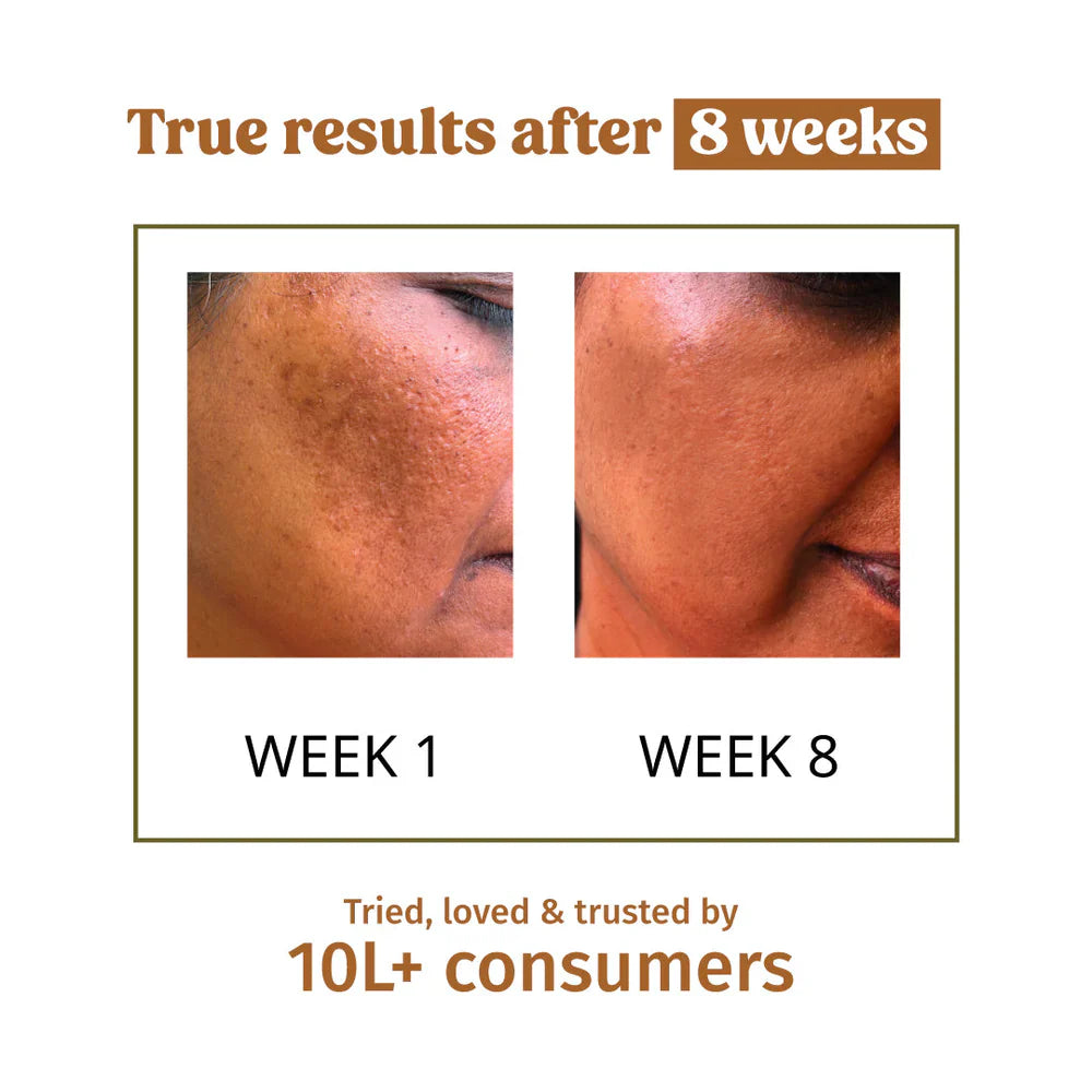 Skin Hydration Kit - Vilvah